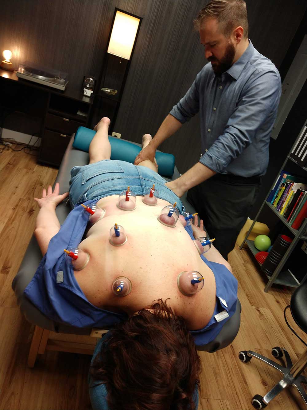 Firsthand Look at Cupping